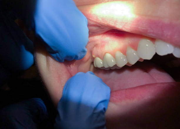 Best Emergency TMJ Treatment in Green Valley, SD