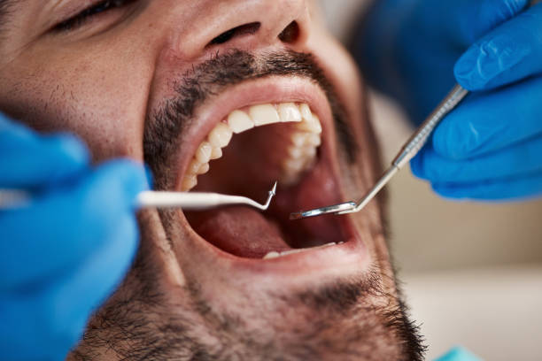 Best Emergency Tooth Extraction in Green Valley, SD